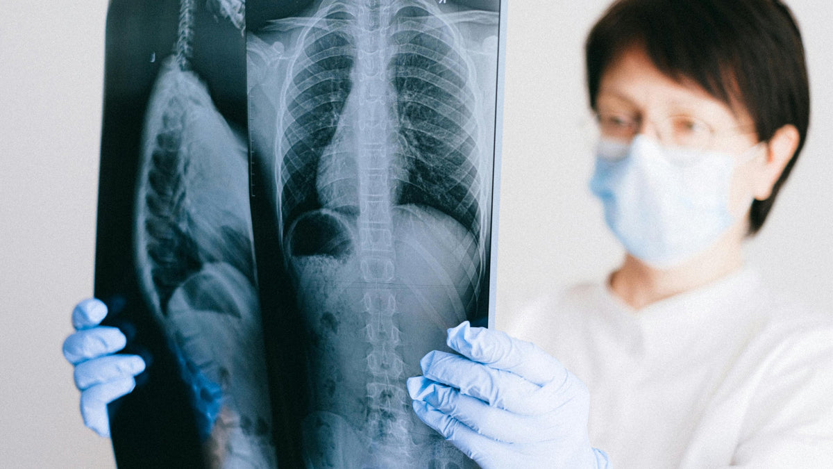 Healthy Lungs of a Nine Realms Customer