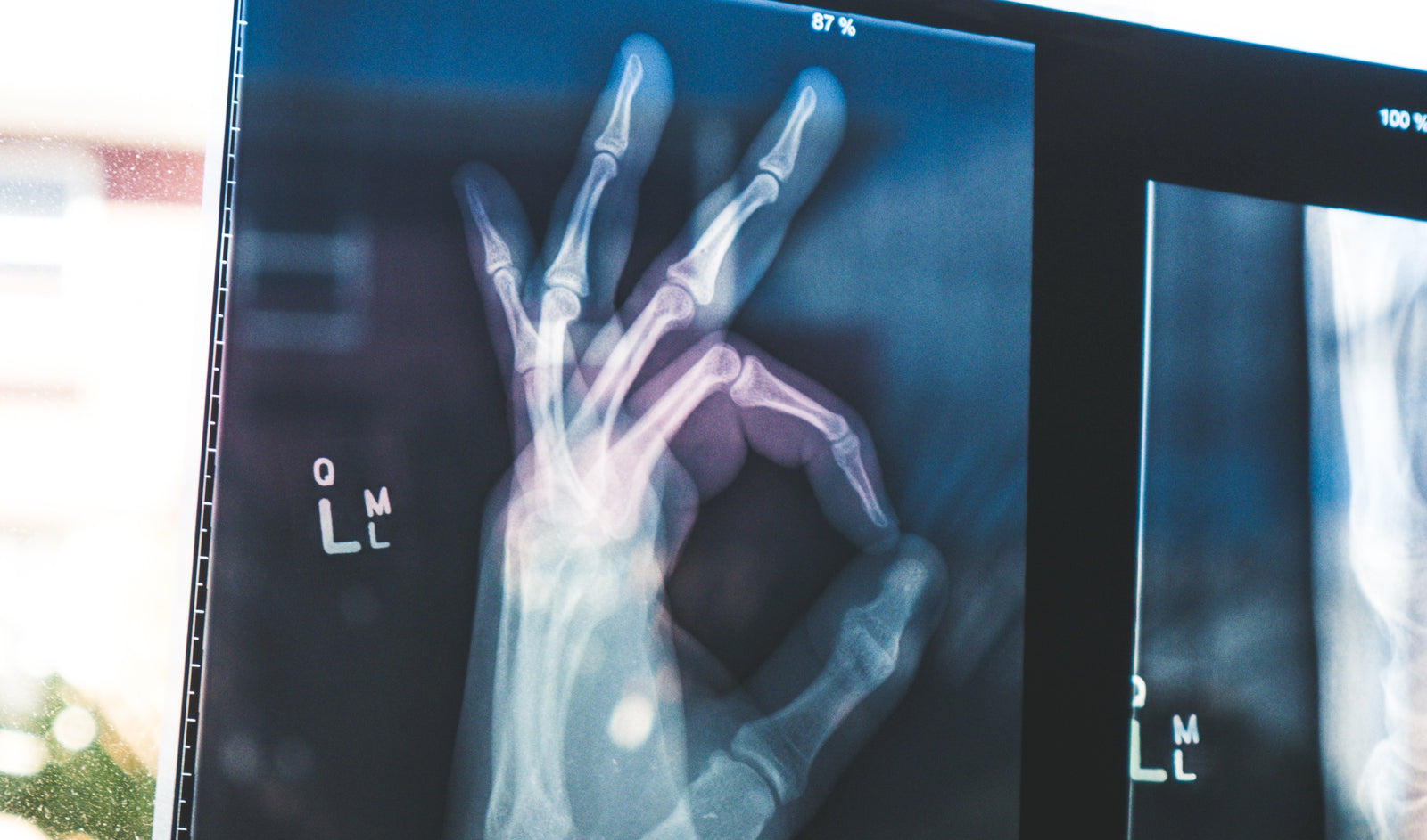 a transparent hand x-ray that's holding the ok sign